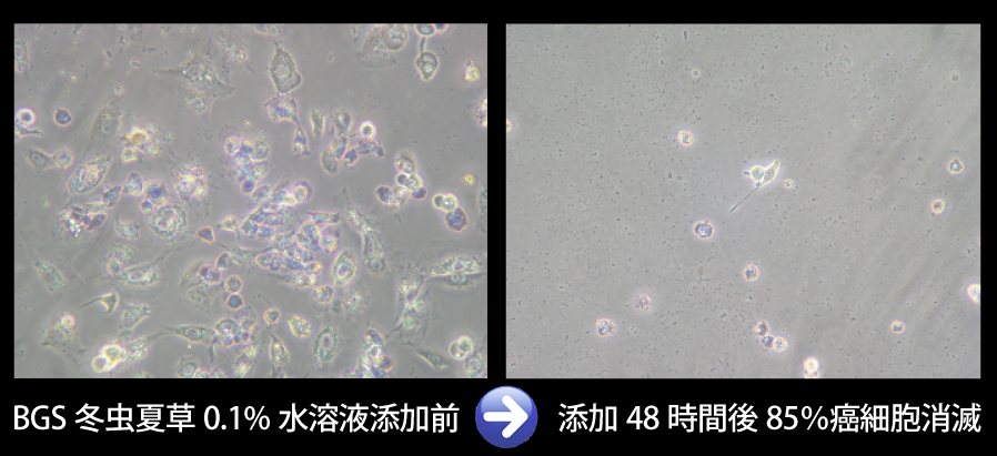 癌細胞消滅