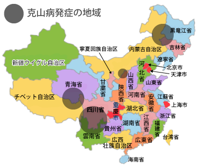 中国克山病地図